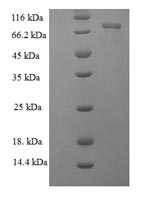 Recombinant Helicobacter pylori Glutamate--tRNA ligase 1 (gltX1) – Figure 1 of 1
