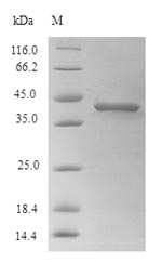 (Tris-Glycine gel) Discontinuous SDS-PAGE (reduced) with 5% enrichment gel and 15% separation gel.