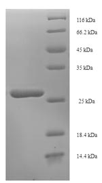 (Tris-Glycine gel) Discontinuous SDS-PAGE (reduced) with 5% enrichment gel and 15% separation gel.
