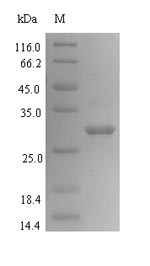 (Tris-Glycine gel) Discontinuous SDS-PAGE (reduced) with 5% enrichment gel and 15% separation gel.