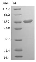 (Tris-Glycine gel) Discontinuous SDS-PAGE (reduced) with 5% enrichment gel and 15% separation gel.