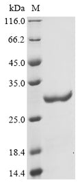 (Tris-Glycine gel) Discontinuous SDS-PAGE (reduced) with 5% enrichment gel and 15% separation gel.