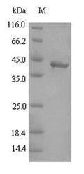 (Tris-Glycine gel) Discontinuous SDS-PAGE (reduced) with 5% enrichment gel and 15% separation gel.