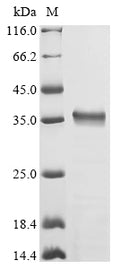 (Tris-Glycine gel) Discontinuous SDS-PAGE (reduced) with 5% enrichment gel and 15% separation gel.