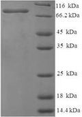 Recombinant Chicken Vitellogenin-1 (VTG1), partial – Figure 1 of 1