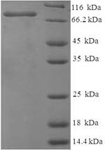Recombinant Chicken Vitellogenin-1 (VTG1), partial – Figure 1 of 1