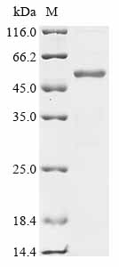 (Tris-Glycine gel) Discontinuous SDS-PAGE (reduced) with 5% enrichment gel and 15% separation gel.