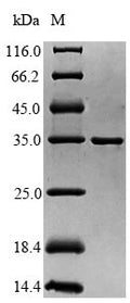 (Tris-Glycine gel) Discontinuous SDS-PAGE (reduced) with 5% enrichment gel and 15% separation gel.