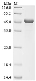 (Tris-Glycine gel) Discontinuous SDS-PAGE (reduced) with 5% enrichment gel and 15% separation gel.