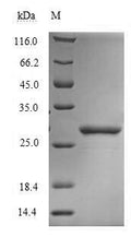 Recombinant Dermatophagoides farinae Mite group 2 allergen Der f 2 (DERF2) – Figure 1 of 1