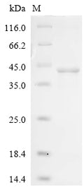 (Tris-Glycine gel) Discontinuous SDS-PAGE (reduced) with 5% enrichment gel and 15% separation gel.