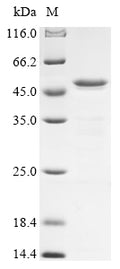 (Tris-Glycine gel) Discontinuous SDS-PAGE (reduced) with 5% enrichment gel and 15% separation gel.