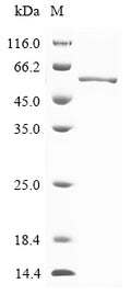 (Tris-Glycine gel) Discontinuous SDS-PAGE (reduced) with 5% enrichment gel and 15% separation gel.