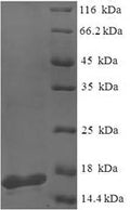 Recombinant Pseudomonas aeruginosa PA-I galactophilic lectin (lecA) – Figure 1 of 1