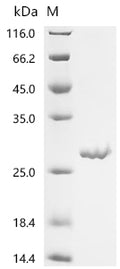 (Tris-Glycine gel) Discontinuous SDS-PAGE (reduced) with 5% enrichment gel and 15% separation gel.