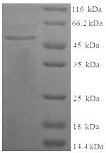 Recombinant Human Complement C4-B (C4B), partial – Figure 1 of 1