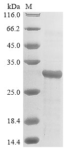 (Tris-Glycine gel) Discontinuous SDS-PAGE (reduced) with 5% enrichment gel and 15% separation gel.