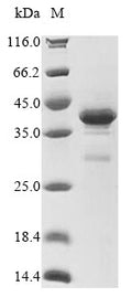 (Tris-Glycine gel) Discontinuous SDS-PAGE (reduced) with 5% enrichment gel and 15% separation gel.