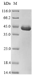 (Tris-Glycine gel) Discontinuous SDS-PAGE (reduced) with 5% enrichment gel and 15% separation gel.