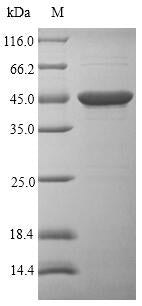 (Tris-Glycine gel) Discontinuous SDS-PAGE (reduced) with 5% enrichment gel and 15% separation gel.