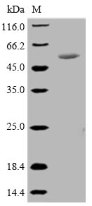 (Tris-Glycine gel) Discontinuous SDS-PAGE (reduced) with 5% enrichment gel and 15% separation gel.