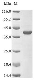 (Tris-Glycine gel) Discontinuous SDS-PAGE (reduced) with 5% enrichment gel and 15% separation gel.