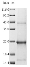 (Tris-Glycine gel) Discontinuous SDS-PAGE (reduced) with 5% enrichment gel and 15% separation gel.