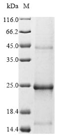 (Tris-Glycine gel) Discontinuous SDS-PAGE (reduced) with 5% enrichment gel and 15% separation gel.