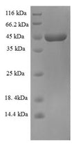 Recombinant Zaire ebolavirus Super small secreted glycoprotein (GP) – Figure 1 of 1
