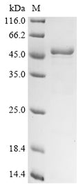 (Tris-Glycine gel) Discontinuous SDS-PAGE (reduced) with 5% enrichment gel and 15% separation gel.