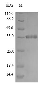 (Tris-Glycine gel) Discontinuous SDS-PAGE (reduced) with 5% enrichment gel and 15% separation gel.