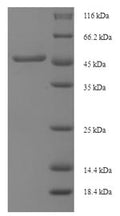 Recombinant Mycobacterium tuberculosis Diacylglycerol acyltransferase/mycolyltransferase Ag85B (fbpB) – Figure 1 of 1