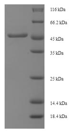 Recombinant Mycobacterium tuberculosis Diacylglycerol acyltransferase/mycolyltransferase Ag85B (fbpB) – Figure 1 of 1