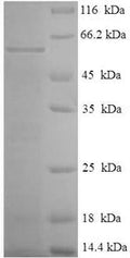 Recombinant Mycoplasma hyopneumoniae 46KDA surface antigen (p46) – Figure 1 of 1