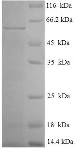 Recombinant Mycoplasma hyopneumoniae 46KDA surface antigen (p46) – Figure 1 of 1