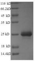 Recombinant Mannheimia haemolytica Leukotoxin (lktA), partial – Figure 1 of 1