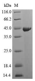 (Tris-Glycine gel) Discontinuous SDS-PAGE (reduced) with 5% enrichment gel and 15% separation gel.