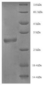 Recombinant Horse Myelin P2 protein (PMP2) – Figure 1 of 1