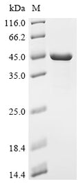 (Tris-Glycine gel) Discontinuous SDS-PAGE (reduced) with 5% enrichment gel and 15% separation gel.