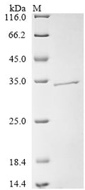 (Tris-Glycine gel) Discontinuous SDS-PAGE (reduced) with 5% enrichment gel and 15% separation gel.