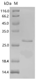 Recombinant Chlamydia trachomatis serovar D Histone H1-like protein Hc1 (hctA) – Figure 1 of 1