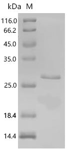Recombinant Chlamydia trachomatis serovar D Histone H1-like protein Hc1 (hctA) – Figure 1 of 1