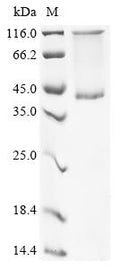 (Tris-Glycine gel) Discontinuous SDS-PAGE (reduced) with 5% enrichment gel and 15% separation gel.