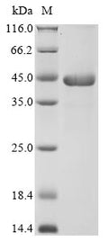 (Tris-Glycine gel) Discontinuous SDS-PAGE (reduced) with 5% enrichment gel and 15% separation gel.