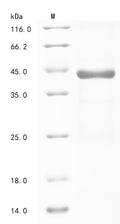 (Tris-Glycine gel) Discontinuous SDS-PAGE (reduced) with 5% enrichment gel and 15% separation gel.