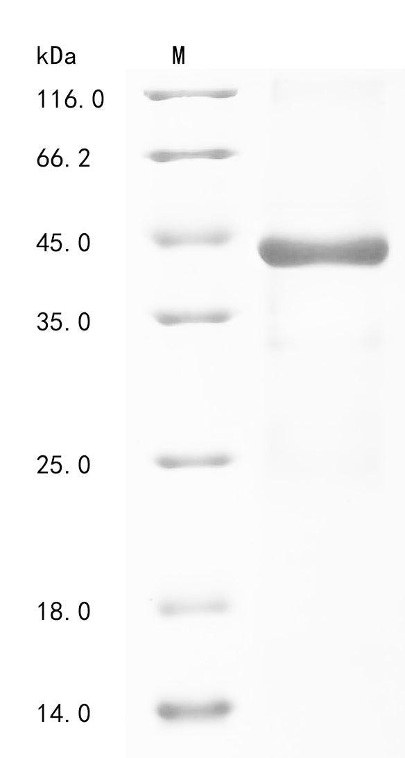 (Tris-Glycine gel) Discontinuous SDS-PAGE (reduced) with 5% enrichment gel and 15% separation gel.