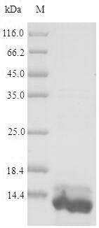 (Tris-Glycine gel) Discontinuous SDS-PAGE (reduced) with 5% enrichment gel and 15% separation gel.