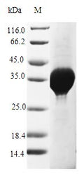 (Tris-Glycine gel) Discontinuous SDS-PAGE (reduced) with 5% enrichment gel and 15% separation gel.