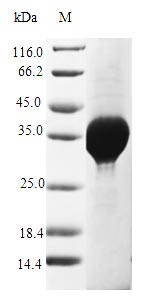 (Tris-Glycine gel) Discontinuous SDS-PAGE (reduced) with 5% enrichment gel and 15% separation gel.