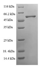 Recombinant Chicken Ovoinhibitor (OIH), partial – Figure 1 of 1